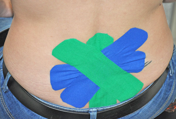 Gemeinschaftspraxis Wallerfangen: Tape-Verbände, Kinesio-Tape